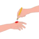 AFTER BITE ΓΙΑ ΜΕΤΑ ΤΟ ΤΣΙΜΠΗΜΑ ΣΤΙΚ 16ml - Image 3